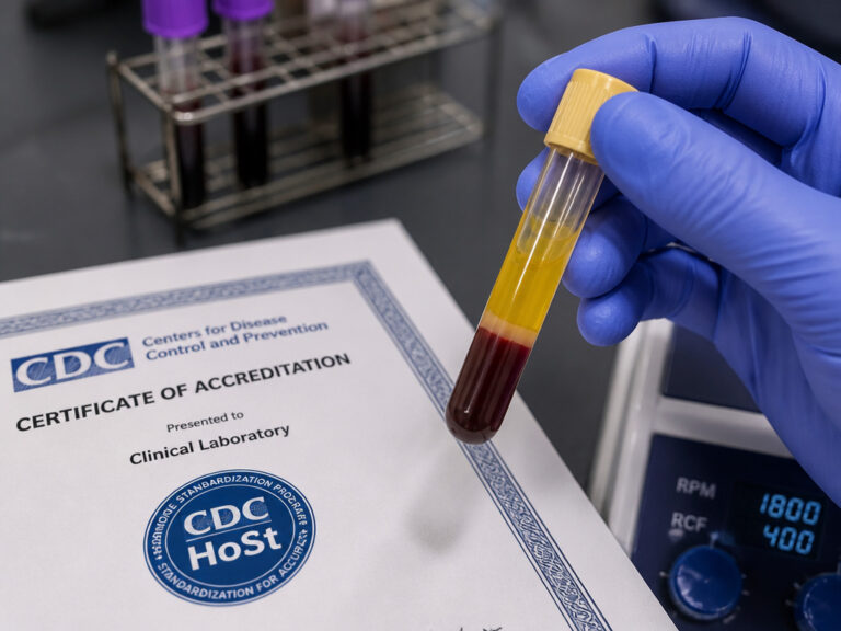 How to Prepare for a Testosterone Blood Test: Step-by-Step